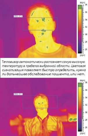 Термограмма человека