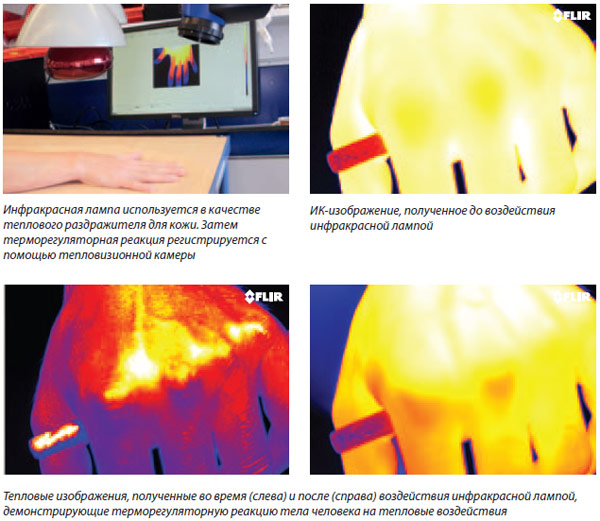 Инфракрасная лампа используется в качестве теплового раздражителя для кожи. Затем терморегуляторная реакция регистрируется с помощью тепловизионной камеры